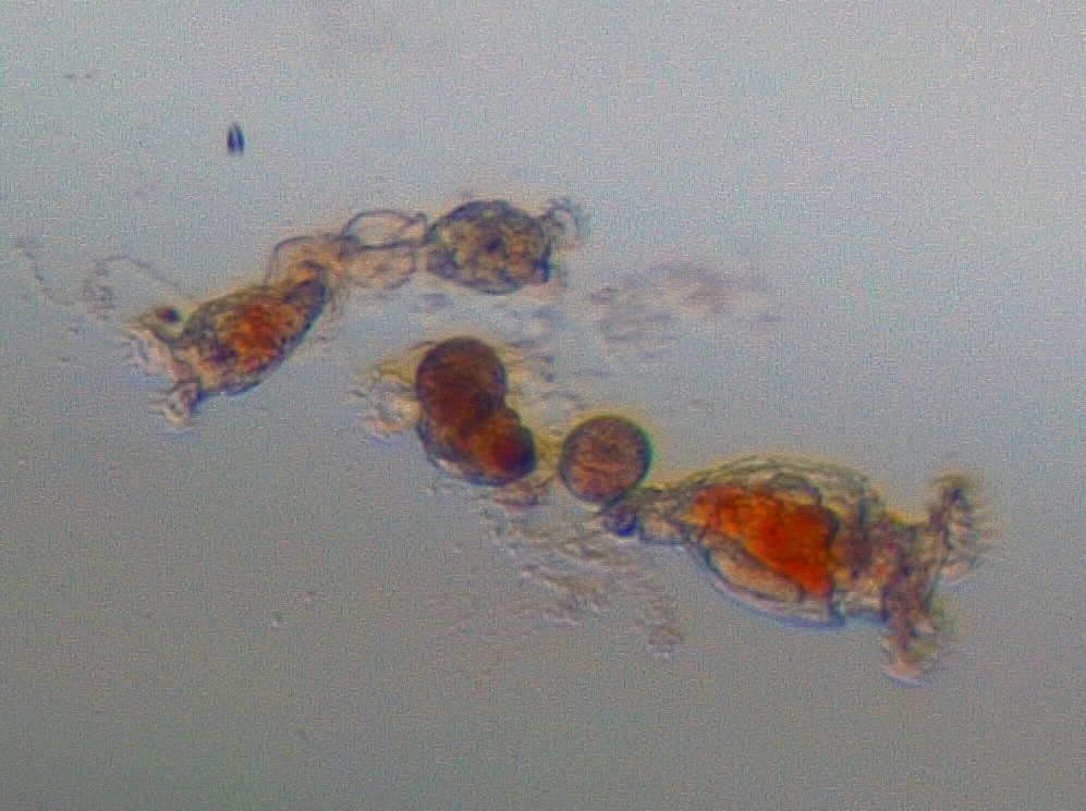 Philodina group with egg